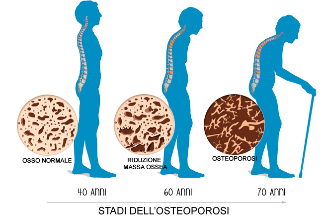 Osteopatia e anziani a Firenze